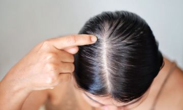 Hair Loss After COVID19 Why It Happens and How to Treat It  SELF