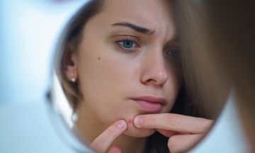 Can skin stress lead to pimples?