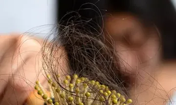 Allopathy vs. homeopathy: Which is the best hair fall treatment?