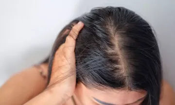 Winter Hair Loss Tips Try These Things To Prevent Hair Fall During This  Season  Trending News