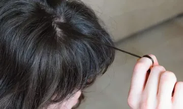 Treat hair pulling disorder with homeopathy