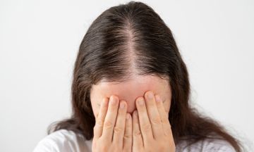 Reasons for hair thinning