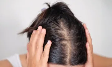 10 bad habits causing hair thinning