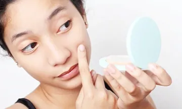 Here’s How You Can Control Body Acne