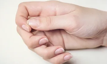 Hypothyroidism and Brittle Nails