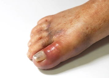 Swelling or redness