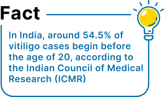 vitiligo Fact