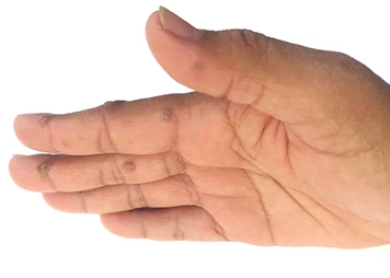 Slide 4